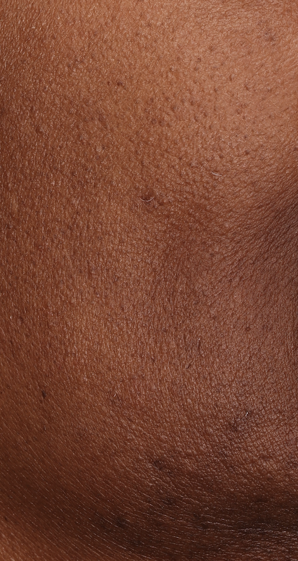 black human skin texture